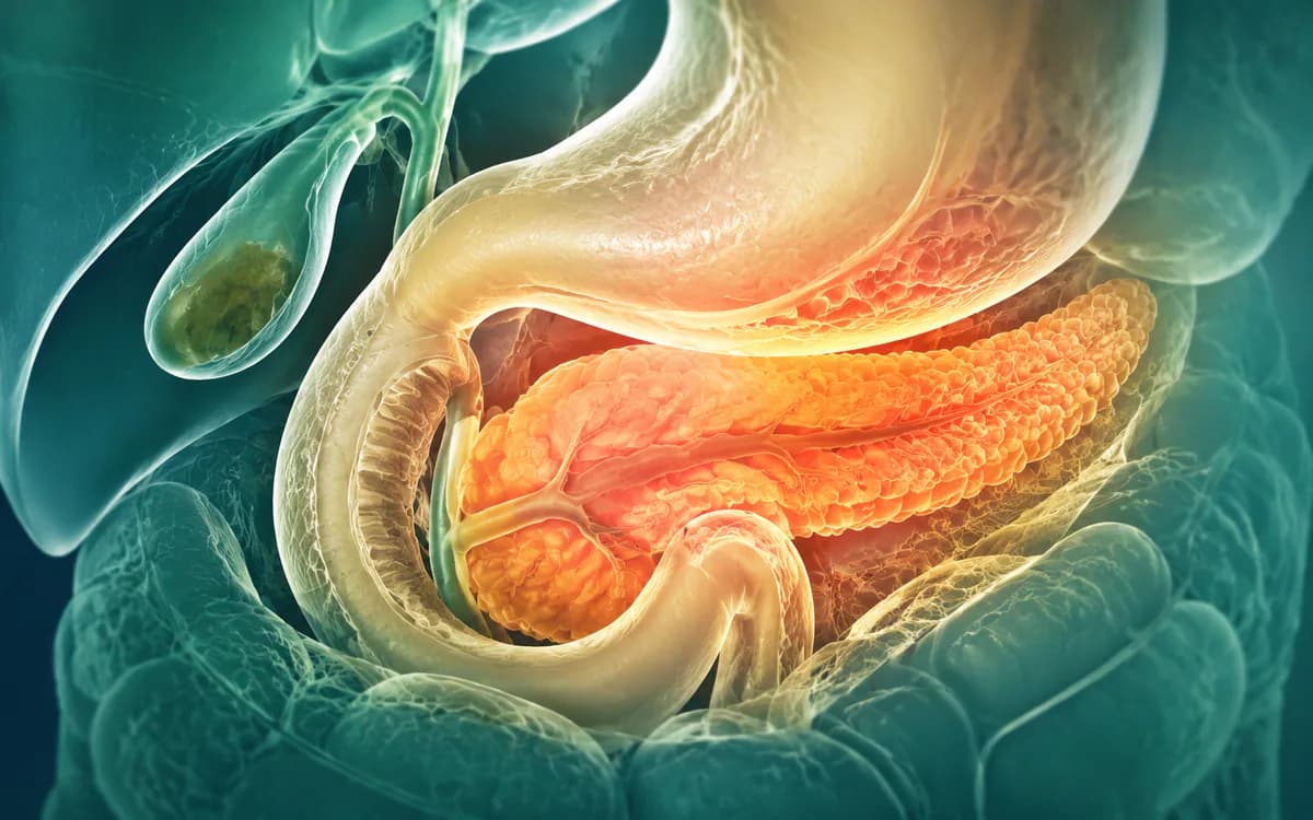 Illustration accompanying Pancreatitis